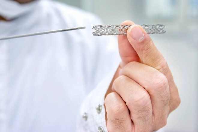 ĐẶT STENT MẠCH VÀNH VÀ NHỮNG LƯU Ý SAU KHI ĐẶT STENT